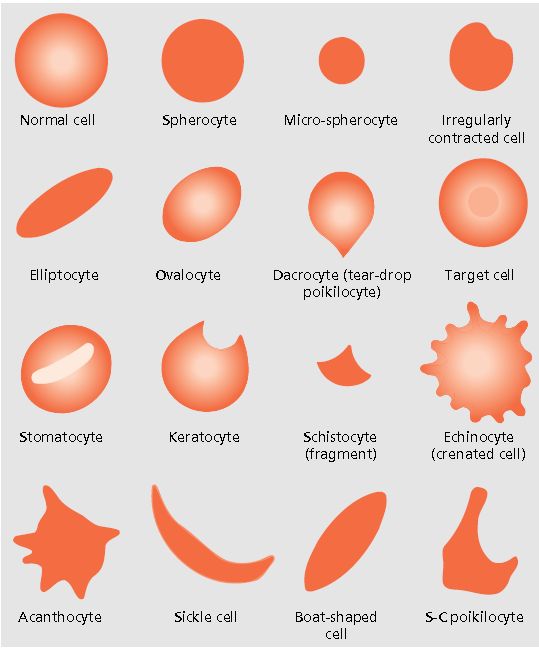 انواع اختلال گلبول قرمز